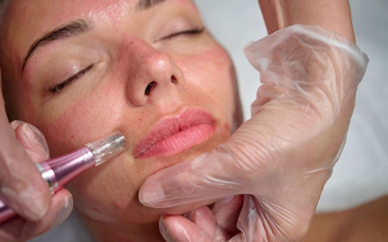 An Insider’s Guide to Anti Aging Treatment