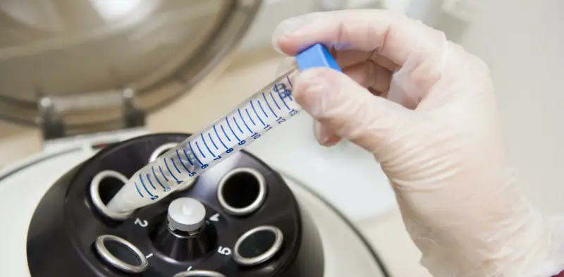 Navigating Your Fertility Journey: What to Expect at San Diego Fertility Center?