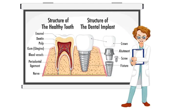 Transform Your Smile With All-On-X Dental Implants Pembroke Pines