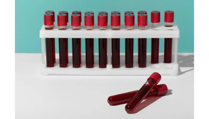 The Truth About Cord Blood Banking Pricing