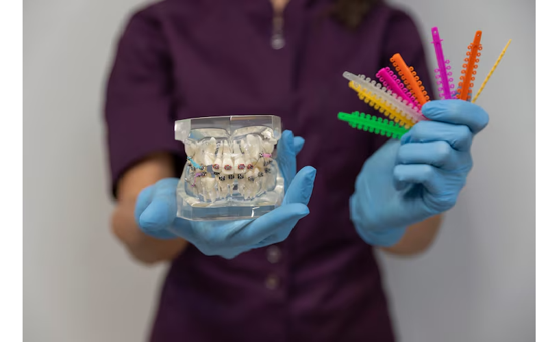 How to Care for Your All on 4 Dental Implants in Pembroke Pines?